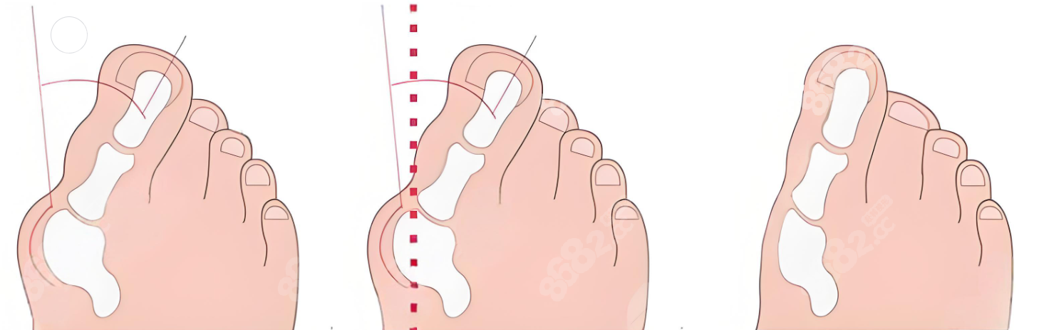 閆超醫(yī)生在北京同仁醫(yī)院坐診