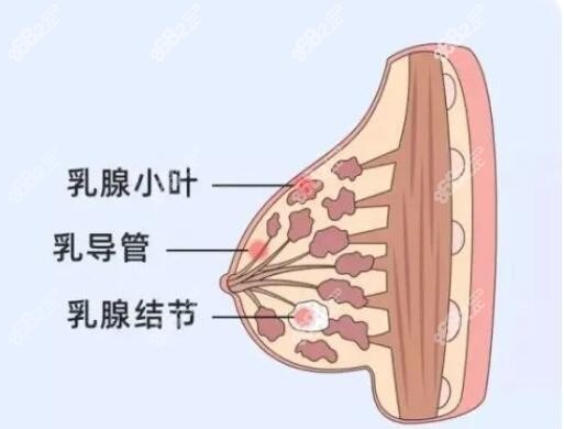 有乳腺增生和结节可以隆胸吗?