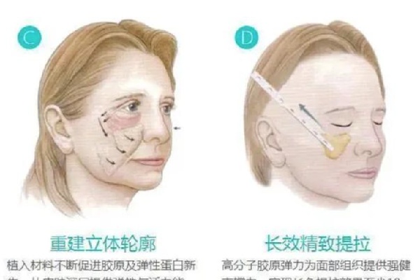 重庆拉皮手术医生排名有倪锋/姜民范/何一波/王科实力上榜
