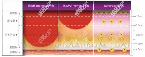上海热玛吉哪里做比较好