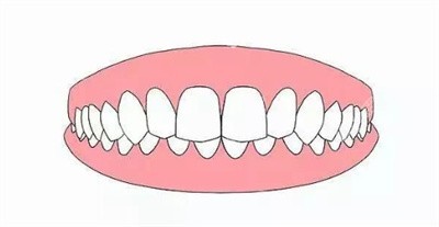 正畸失败的原因3