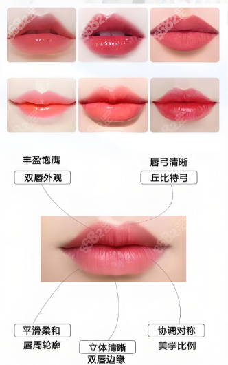 玻尿酸丰唇