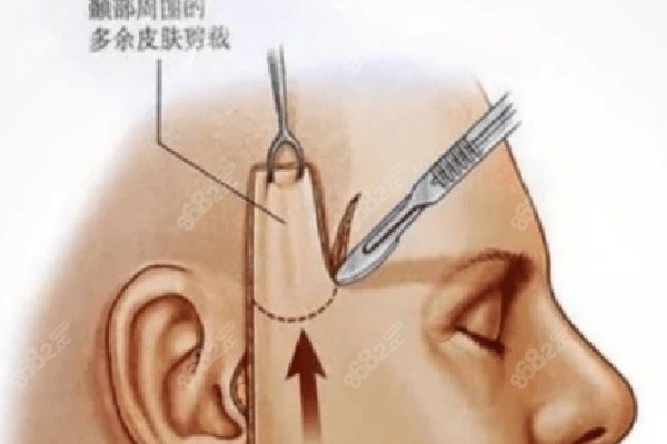 重慶拉皮手術(shù)醫(yī)生排名大揭秘之倪鋒醫(yī)生風(fēng)采