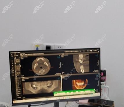 上海中喜优牙口腔建议去的科室