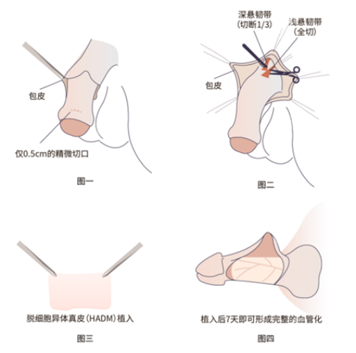 李世荣医生怎么预约