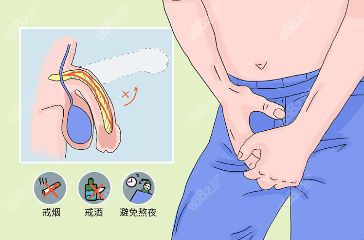 李世荣男性生殖器整形范例