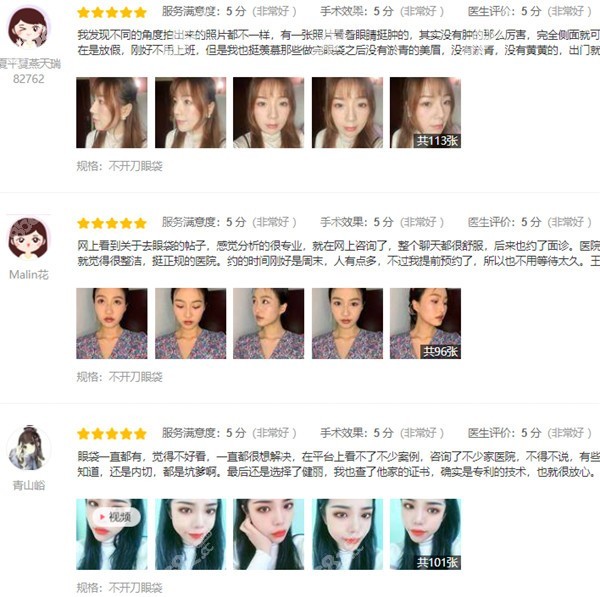 广州健丽去眼袋效果真实评价