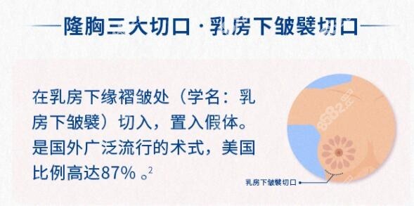 乳房下皱襞切口图片