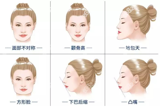 上海磨骨排名前五医院名单推荐