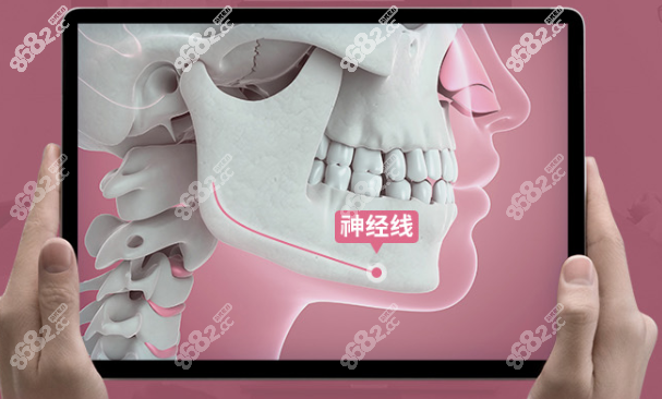 北京磨骨改脸型价格多少钱