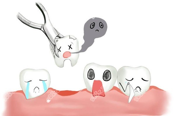 蘇州拔牙去哪個醫(yī)院比較好？