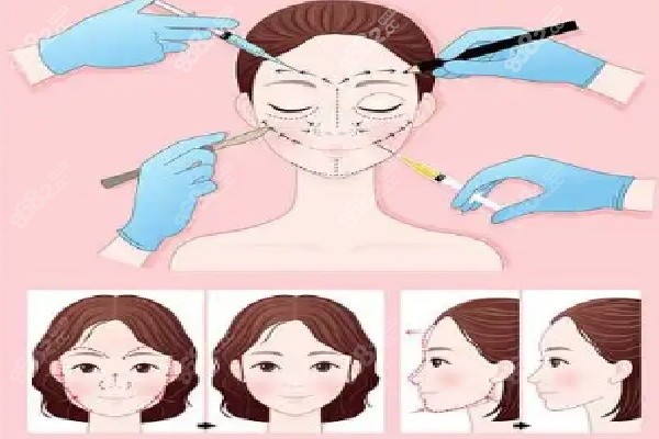 朱自刚医网络平台预约？