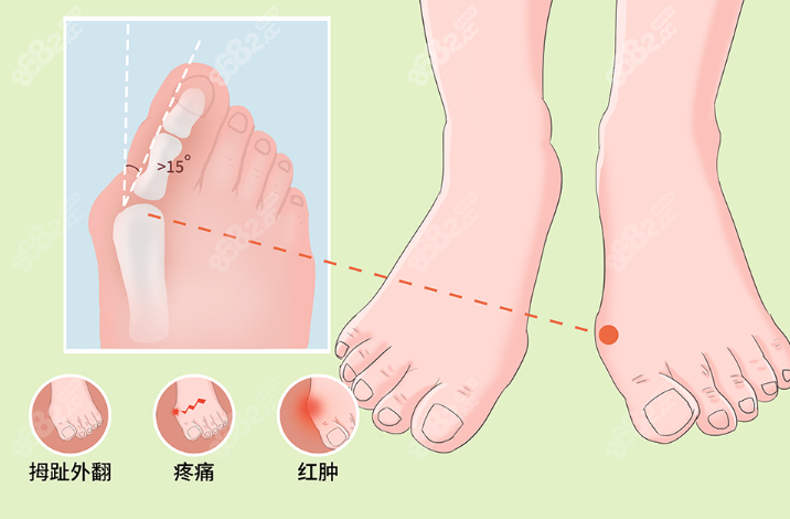 【2025海淀區(qū)】蘇敬達(dá)坐診醫(yī)院地址！微創(chuàng)24H下地+限時(shí)預(yù)約