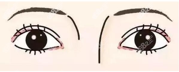 韓國做雙眼皮出名的醫(yī)院有哪些