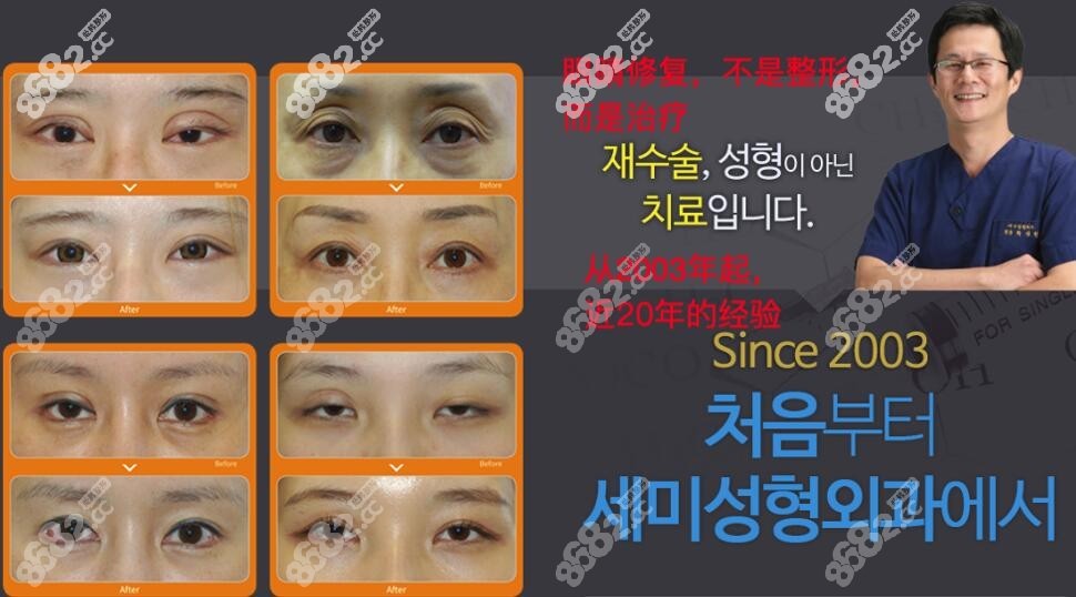 世美整形外科的眼整形病例圖8682.cc