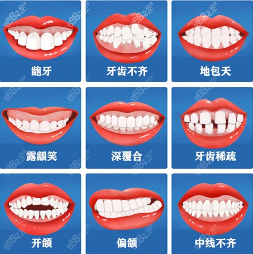 2025北京禾禾齿科正畸收费价目表