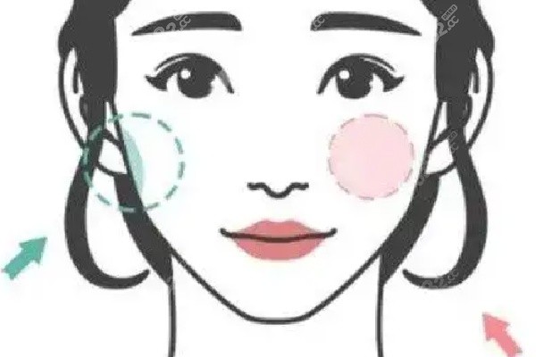 王召東醫(yī)生微創(chuàng)技術(shù)