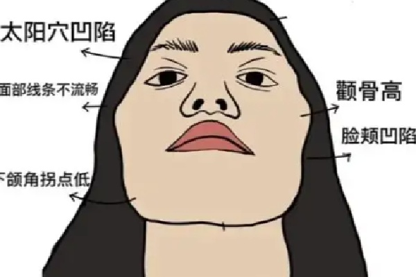 西安顴骨內(nèi)推醫(yī)院哪家好多少錢？推這幾家術(shù)后效果驚艷！