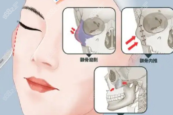 西安艺星整形美容医院的性价比之选