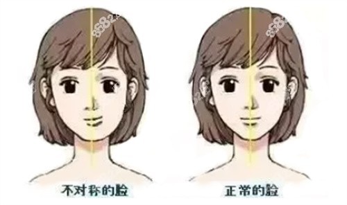 成年后偏颌是不是会越来越歪？