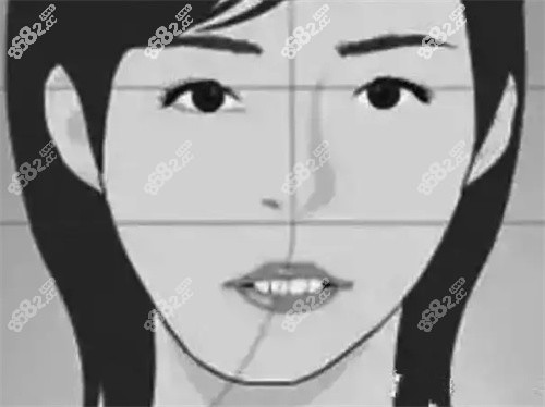 偏颌不矫正会越来越歪吗？