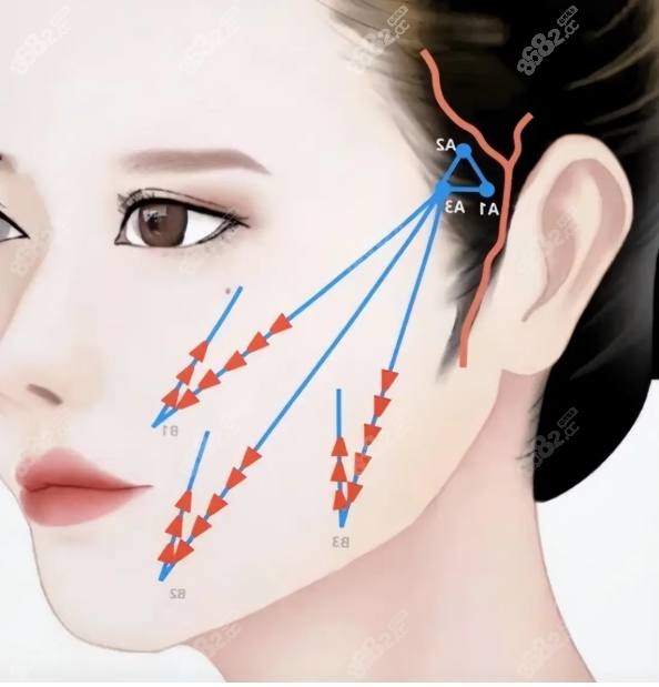 正規(guī)有效的筋膜提升醫(yī)院排名ekelt.cn