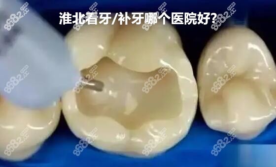 淮北看牙哪个医院好