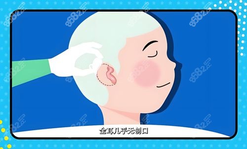 郭树忠耳再造的简历简介