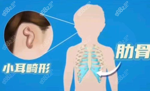 八大處誰做小耳再造好？章慶國/蔣海越/謝洋春耳再造特色