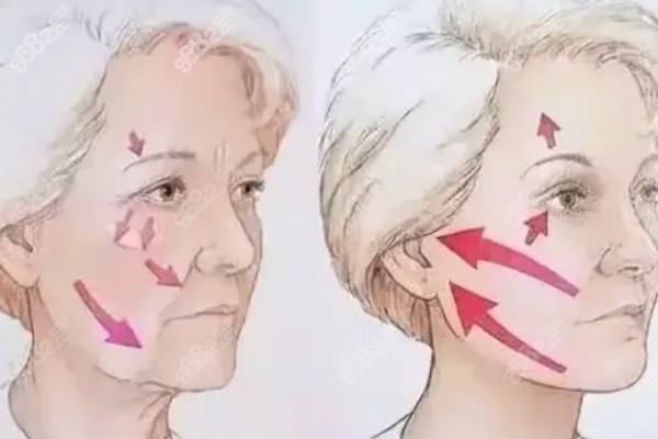 賀煥煥做拉皮真實實例見證實力