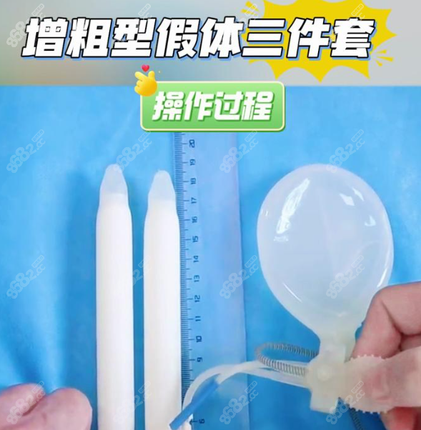 杭州男科醫(yī)生鄧剛做陰莖假體三件套好，能延長(zhǎng)2-6cm/增粗1-3cm