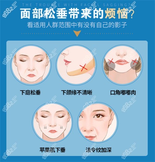 面部松弛的现象