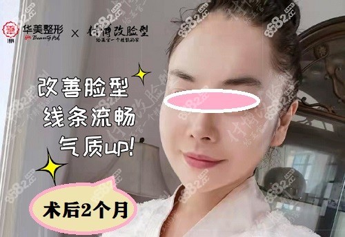 付国友院长下颌角截骨