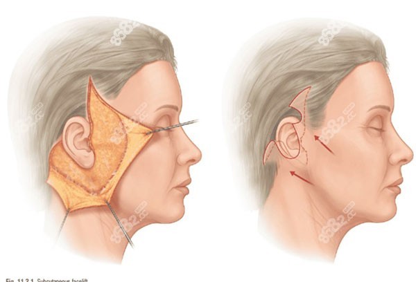 北京加减美V6和V9有什么区别 北京加减美V6和V9有什么区别