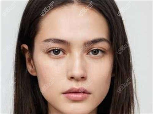 石家庄微笑唇3k和玻尿酸2k选哪个?微笑唇术后多久能打玻尿酸?
