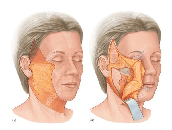 北京加减美V6和V9有什么区别 北京加减美V6和V9有什么区别
