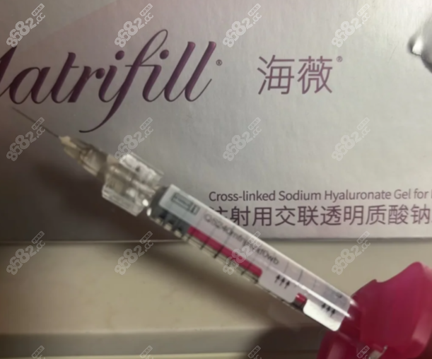 海薇玻尿酸五大优势
