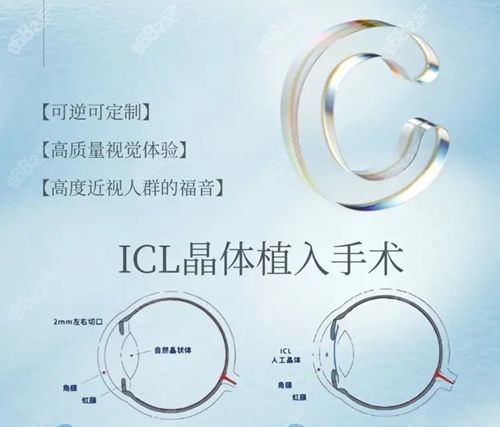 icl晶体植入可以考警校/军校吗?政策未禁止,需提前半年手术