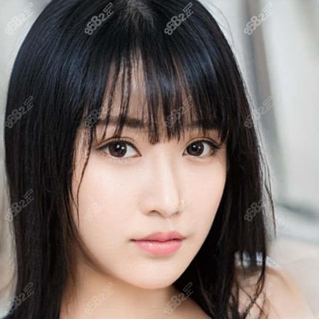 温州丰额头价格表大公开!这几家医院口碑好又靠谱