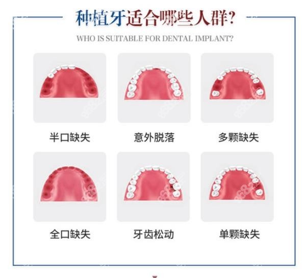 <!--<i data=20240705-sp></i>-->口腔医院做种植牙靠谱吗