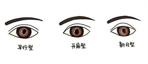 雙眼皮
