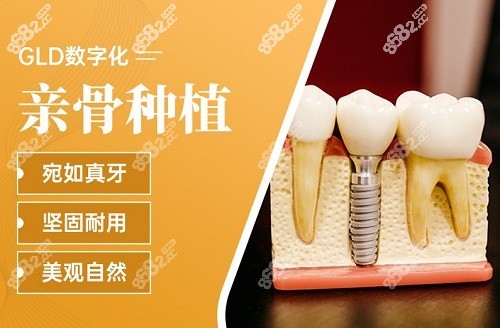 合肥佳冠口腔醫(yī)院種植牙