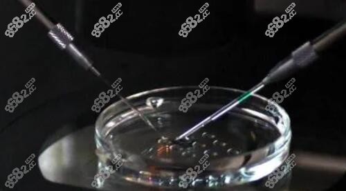 <!--<i data=20240705-sp></i>-->3d植发技术精细提取毛囊m.8682.cc