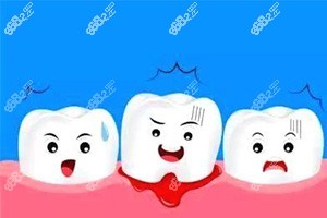 如何预防牙龈炎的出现？