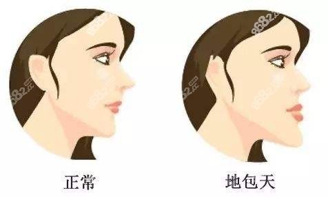 泉州地包天矫正的价格
