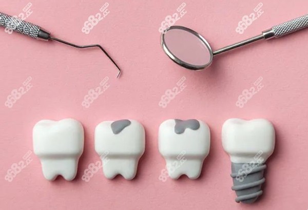 种植牙的过来人一些忠告www.8682.cc