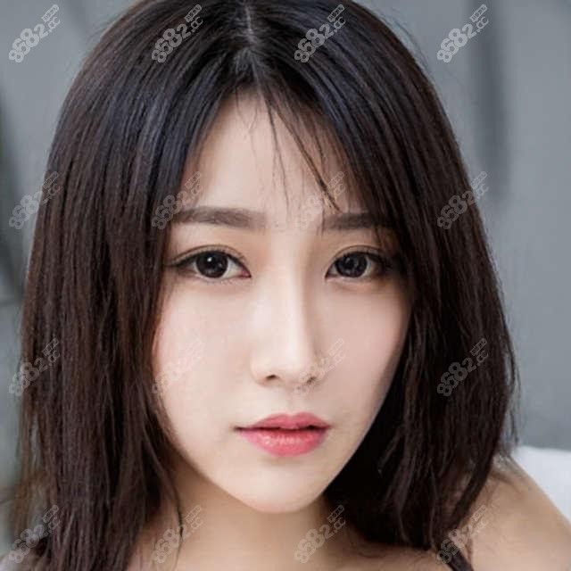 深圳安寶區(qū)粵美口腔牙齒矯正+牙齒美白實(shí)例，牙齒矯正3W起