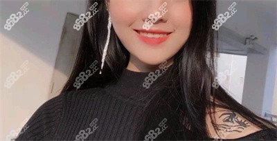 兰宇医生在隆鼻方面的技术优势2