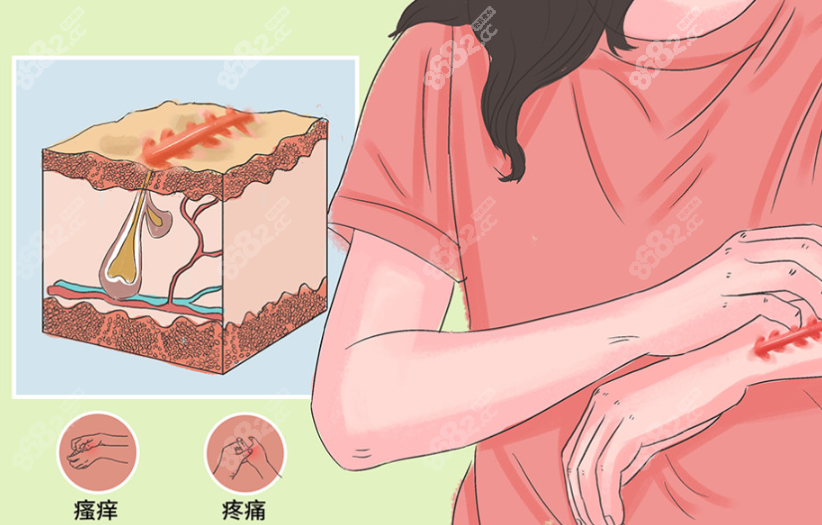 国内做超减张缝合术祛疤十大医院排名评选