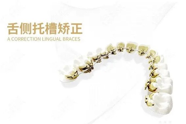 长治部分口腔医院可以做舌侧隐形矫正牙齿